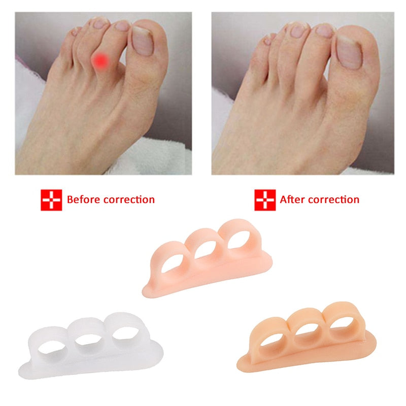 Bunion corrector