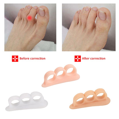 Corrector de juanetes