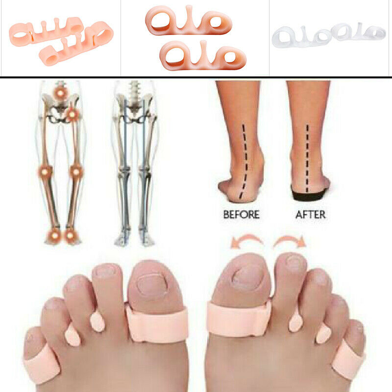 Bunion corrector